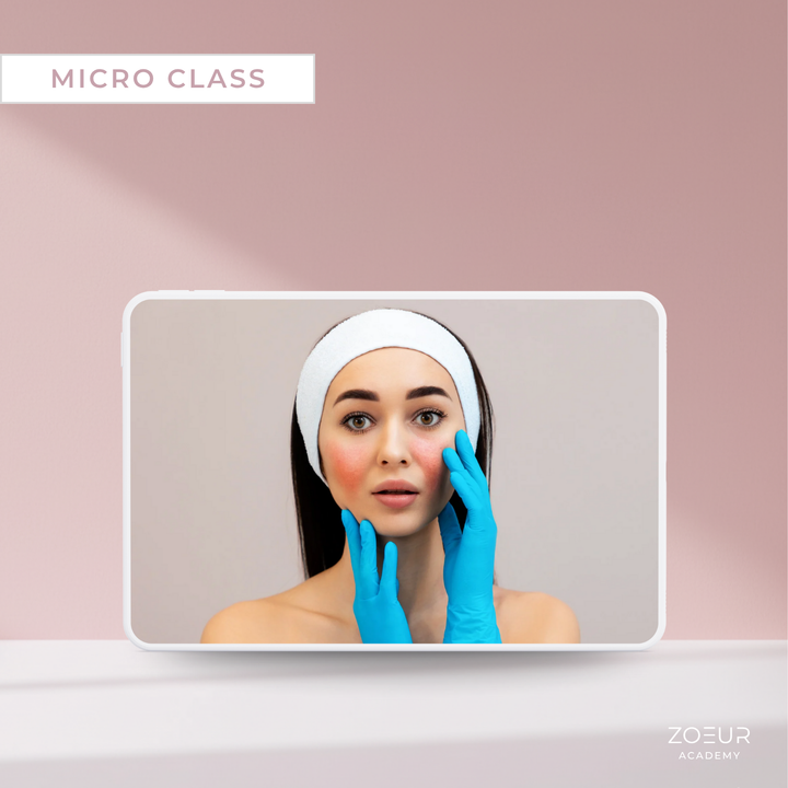 Couperose & erweiterte Äderchen: Micro Class