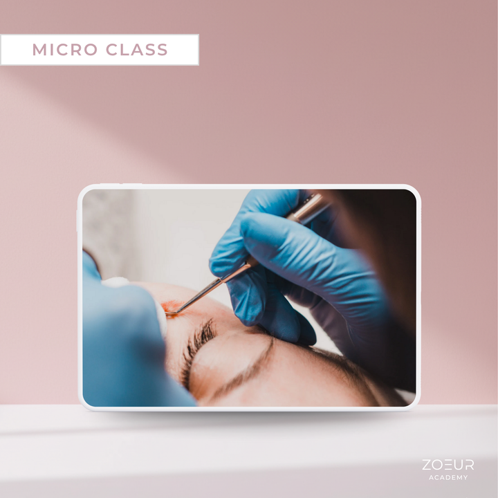 Milien entfernen: Micro Class