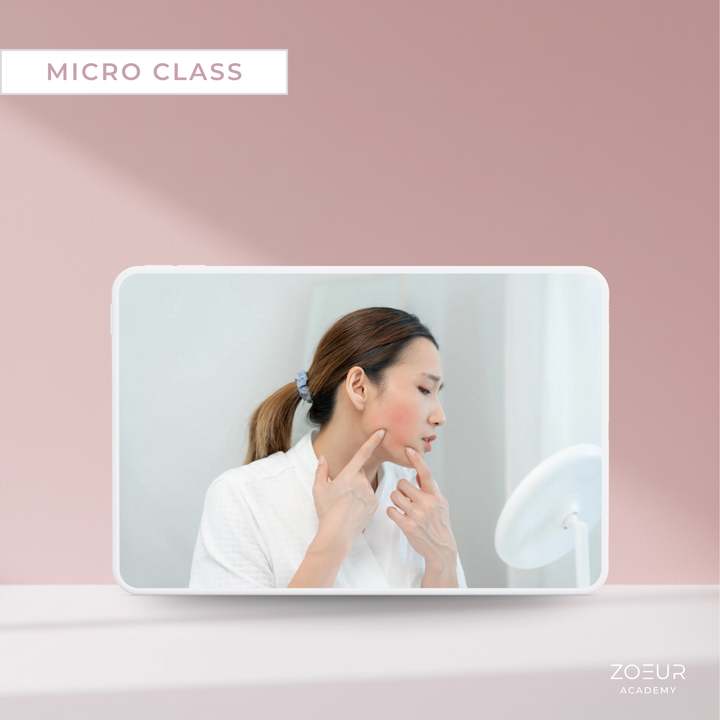 Periorale Dermatitis: Micro Class